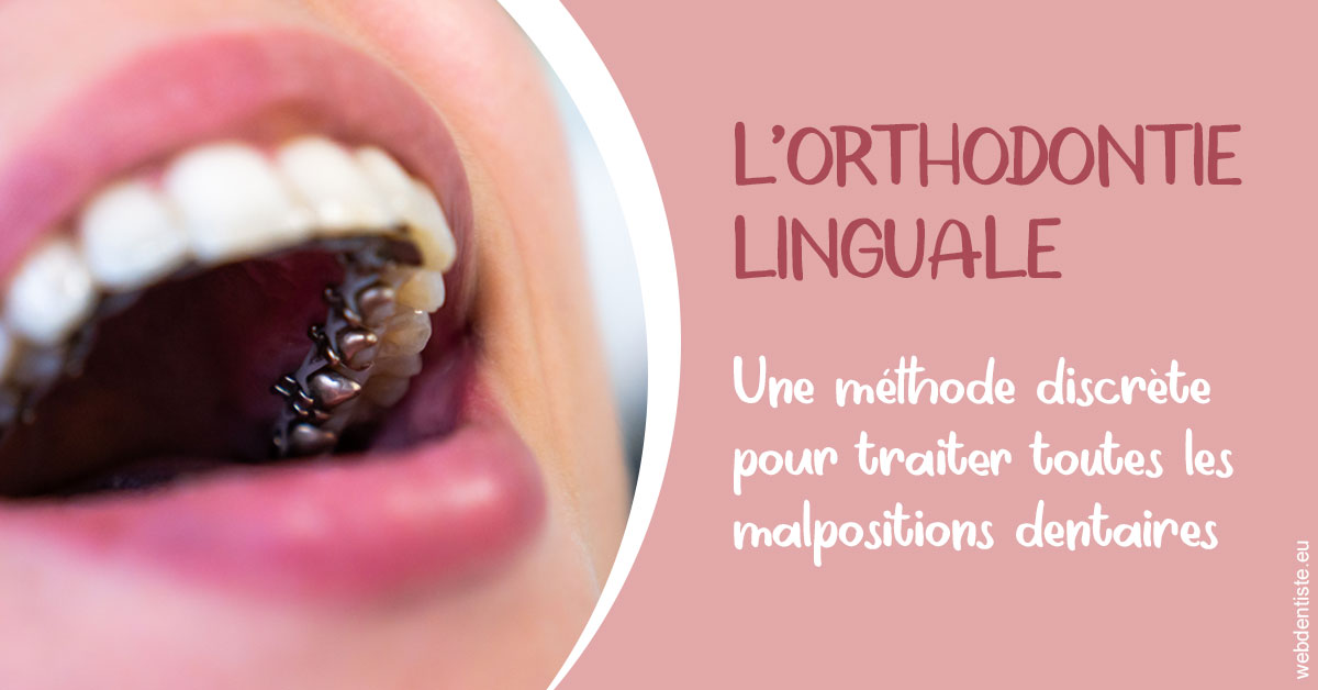 https://dr-thomas-valerie.chirurgiens-dentistes.fr/L'orthodontie linguale 2