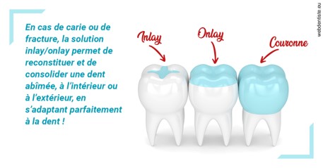 https://dr-thomas-valerie.chirurgiens-dentistes.fr/L'INLAY ou l'ONLAY