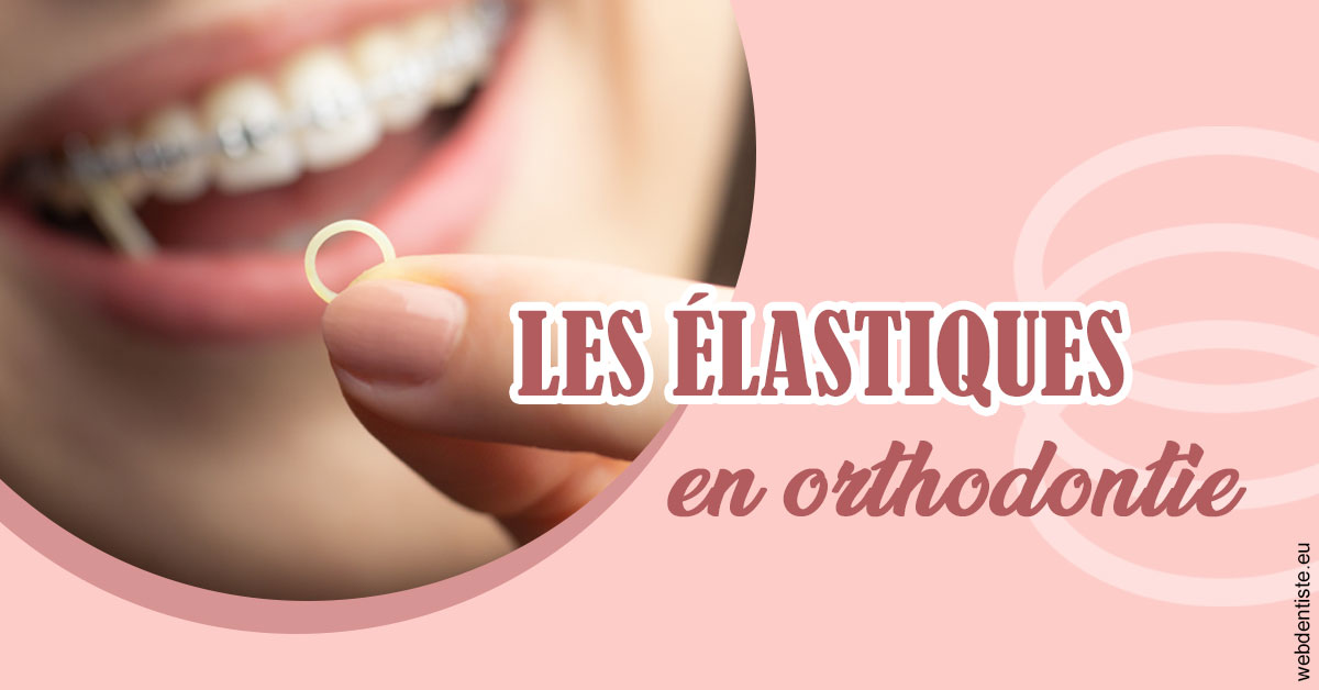 https://dr-thomas-valerie.chirurgiens-dentistes.fr/Elastiques orthodontie 1