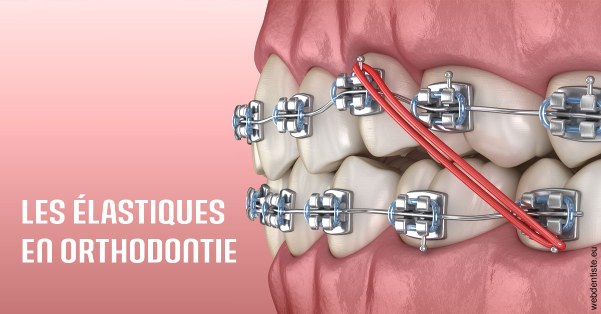 https://dr-thomas-valerie.chirurgiens-dentistes.fr/Elastiques orthodontie 2